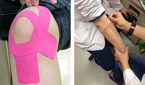 特色治療-肌內效貼布